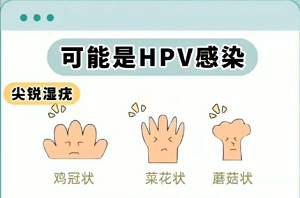 男性HPV感染有什么症状？