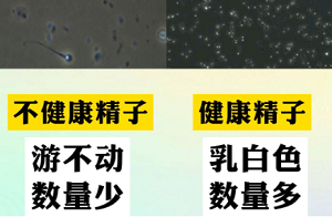 男性精子质量下降怎么办？