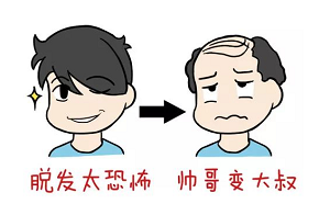 男性脂溢性脱发如何治疗？