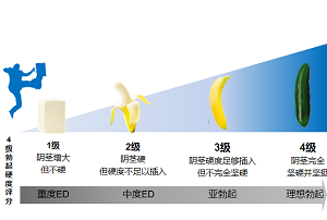 医生会如何评估男性硬度问题？