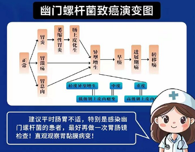 幽门螺旋杆菌感染会导致癌症吗？