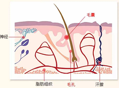 为什么有些人更适合进行毛囊移植？