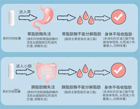 你是否应该服用奥利司他？ - 知乎