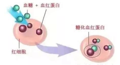 糖化血红蛋白，你知道多少？_HbA1c