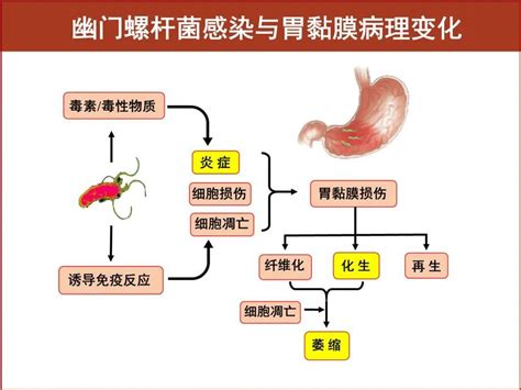 超全面解读，关于幽门螺杆菌，看这一篇文章就够了