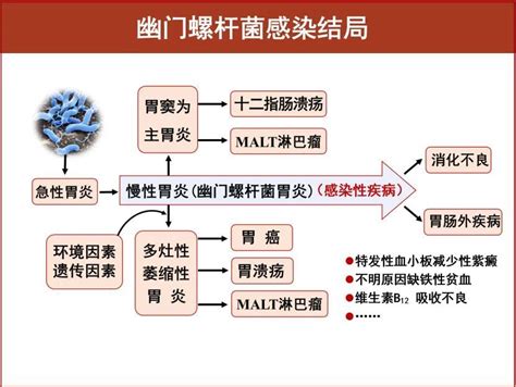 幽门螺杆菌感染图