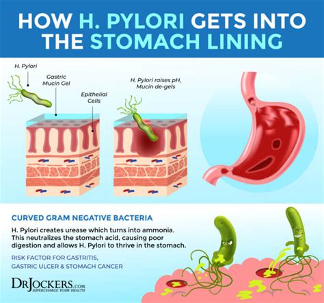 The Damaging Effects of H Pylori Infections 